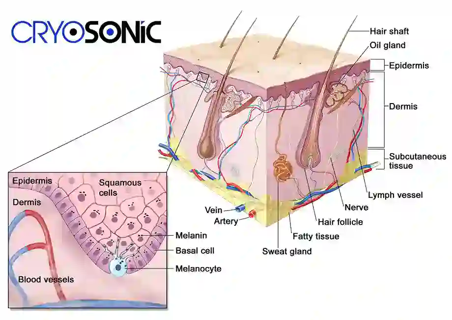 How Cryotherapy Stimulates Melanocyte Activity Scunthorpe